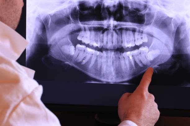 Best Emergency Dentist for Knocked-Out Tooth in Rice, TX