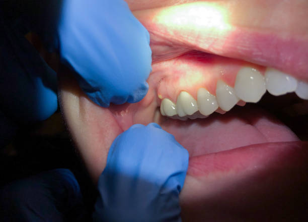 Best Broken or Cracked Tooth Emergency Dentist in Rice, TX