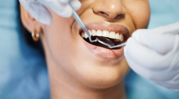 Best Emergency Dental Extractions in Rice, TX