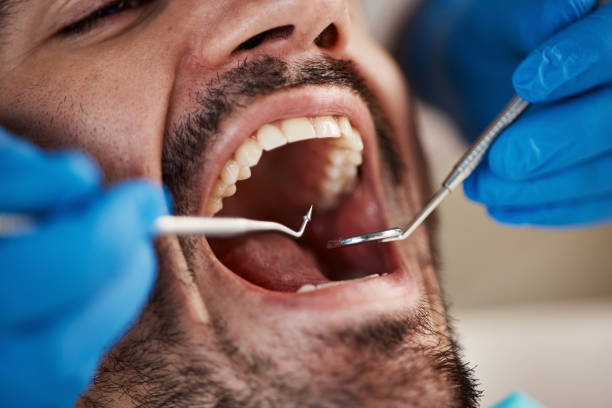 Best Orthodontic Emergency Dentist in Rice, TX
